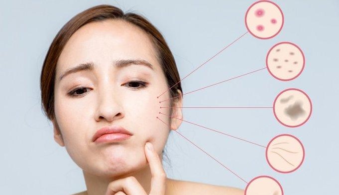 Efek Samping Skincare Omg Pada Kulit Wajah 